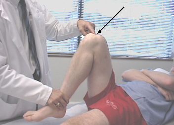 Fleksiyon sırasında dizdeki ağrı, insanların travma doktorlarını ziyaret etmelerinin en yaygın nedenidir. 