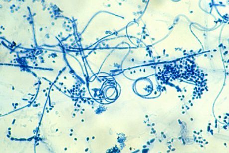 Ayakların epidermofitozunun etken maddesi (Trichophyton interdigitale)